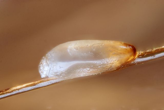 Head louse eggs