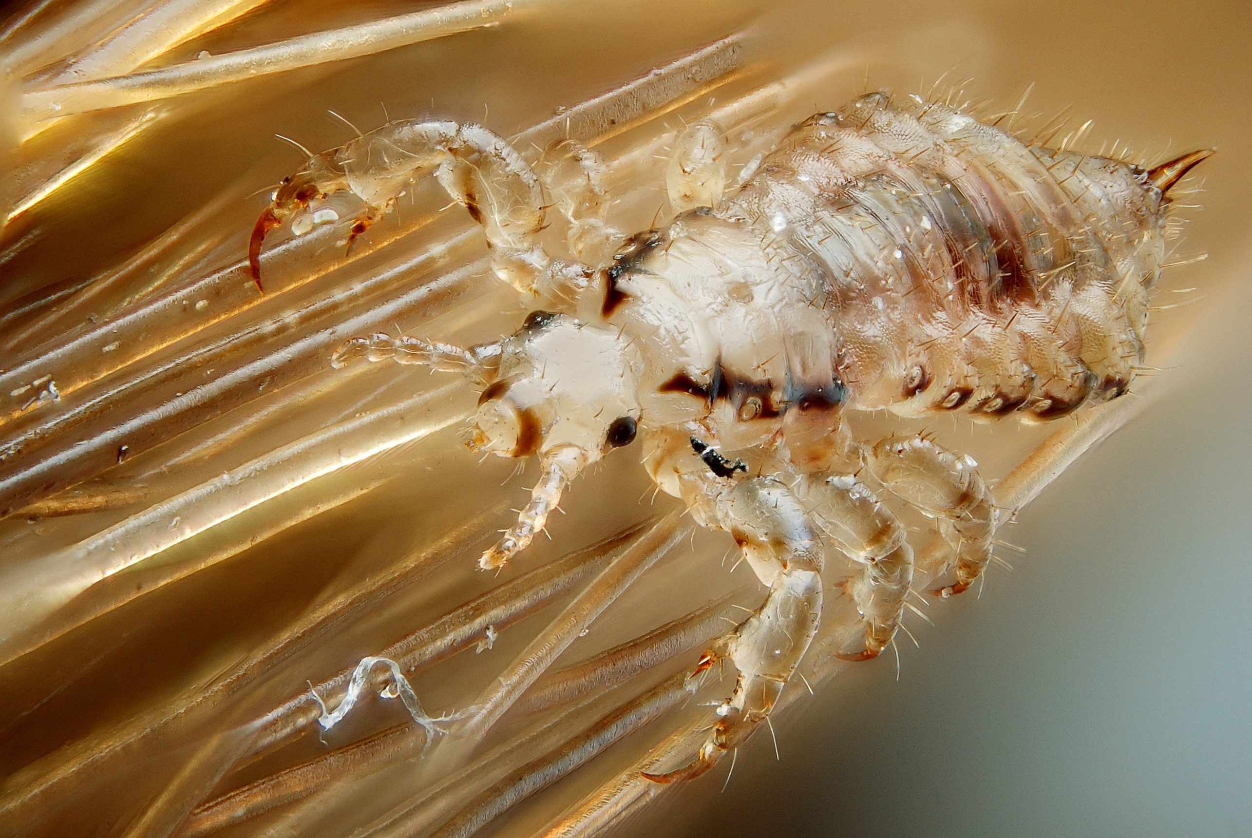 What Do Lice Look Like?