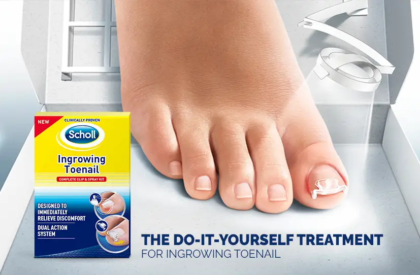 Scholl Treatment For Ingrown Toenails