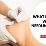 What Happens When Dry Needling Hits A Nerve