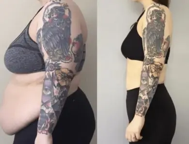Why-Lose-Weight-Before-a-Tattoo