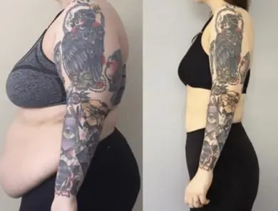 What Happens To Tattoos When You Lose Weight 2 Why-Lose-Weight-Before-a-Tattoo