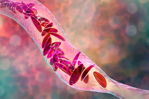 What happens if nerve ablation doesn't work 2 Is a nerve block the same as ablation?