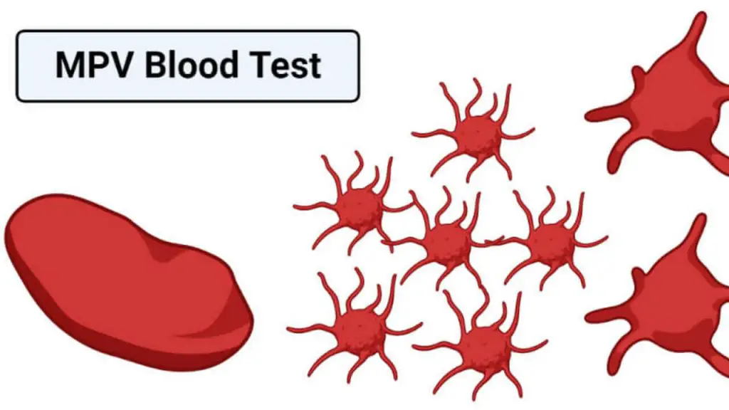 Blood Test