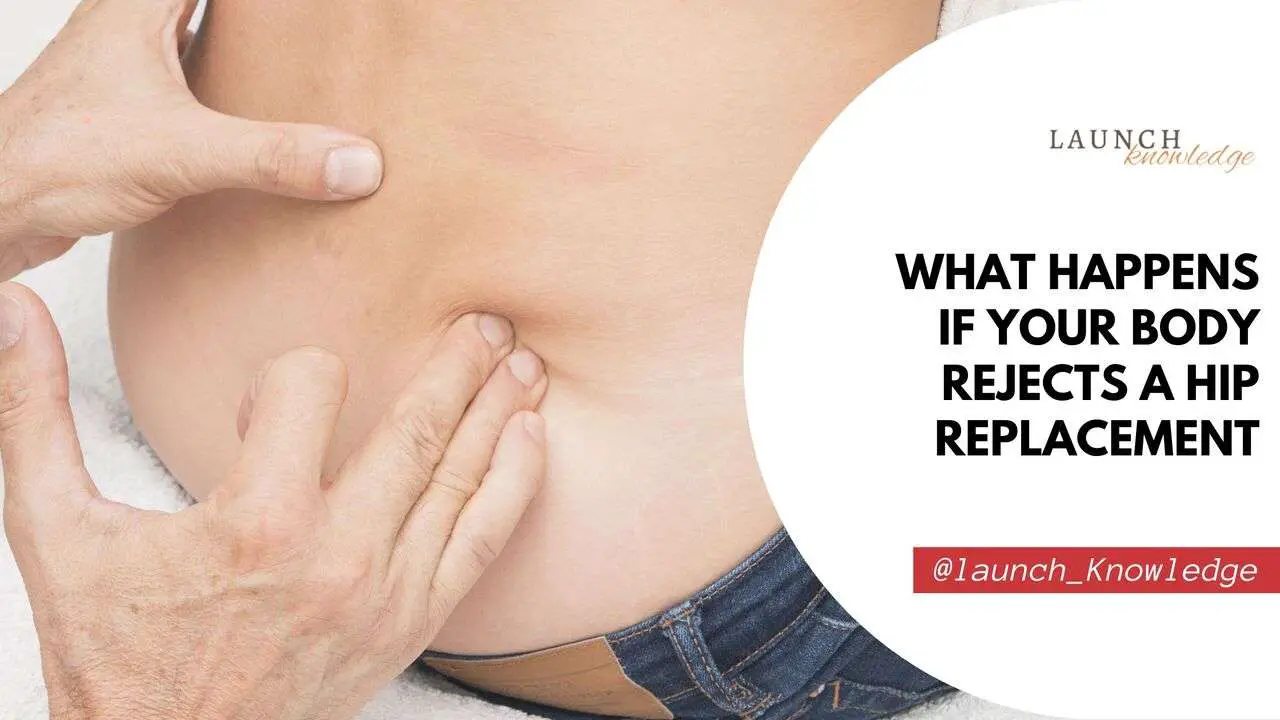 What Happens If Your Body Rejects a Hip Replacement
