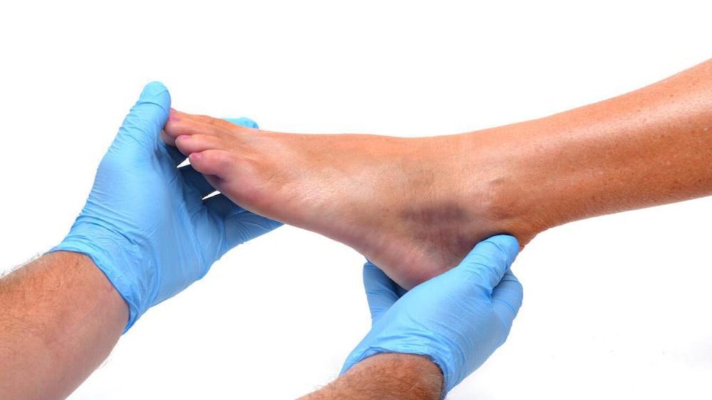 How Long Does Ankle Sprain Take To Heal 1 pain